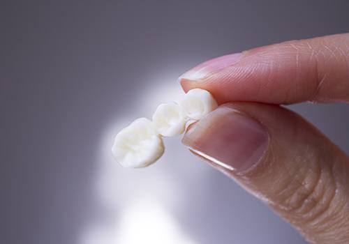 Woman holding a dental bridge