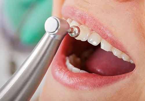 Woman having her teeth polished